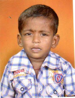 Little child of two years old need help for medical treatment