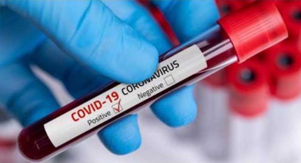 32 coronavirus cases in Udupi in a day, district tally rises to 108