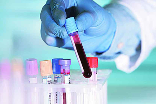 Bengaluru family tested for Coronavirus after neighbours alert health officials Bengaluru family tested for Coronavirus after neighbours alert health officials