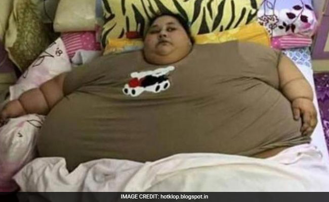 At 500 Kilos, This Woman Is Believed To Be Fattest In The World