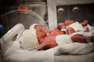 â€˜Genetically maleâ€™ woman gives birth to twins