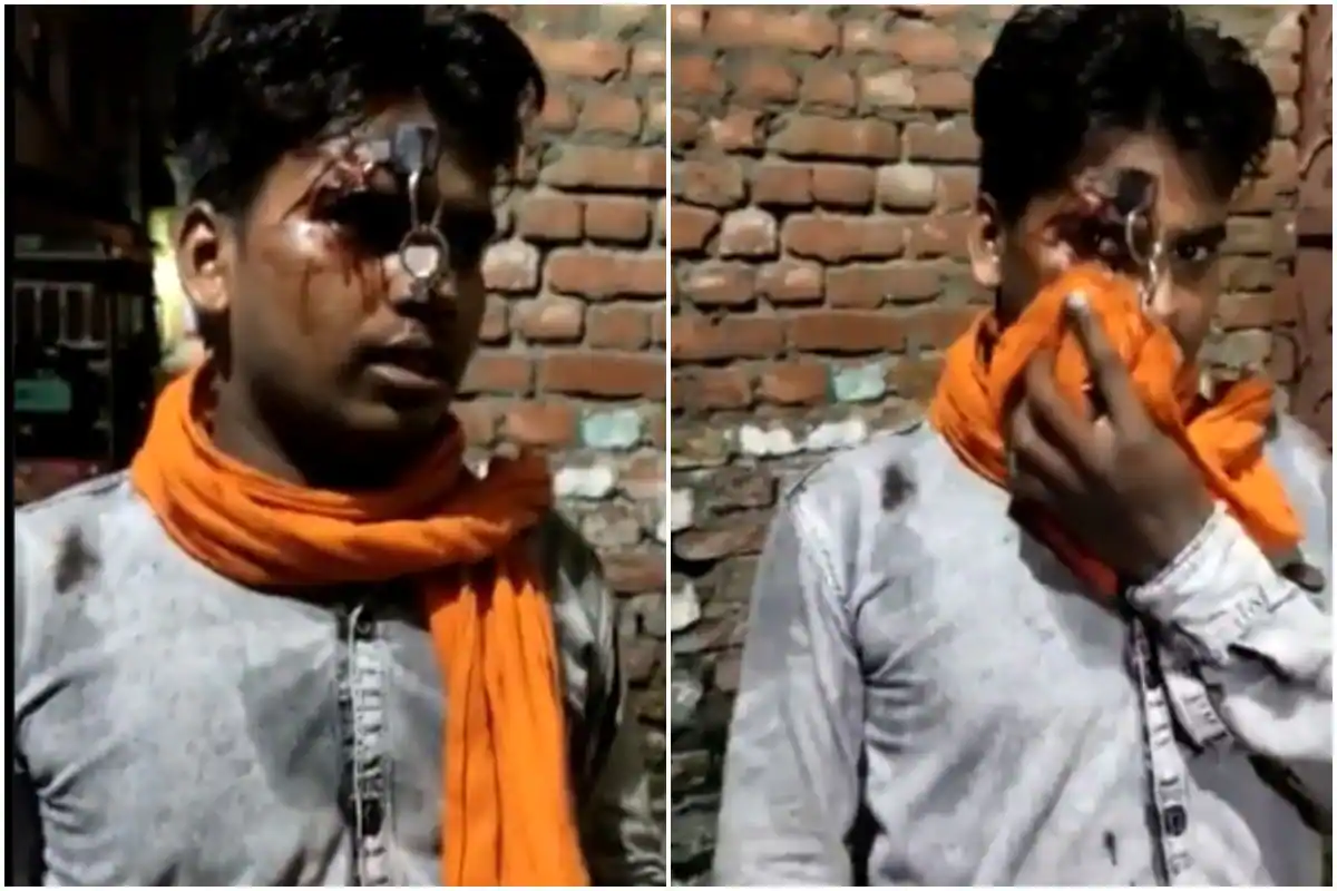 Uttarakhand cops thrust key in man’s forehead for not wearing helmet