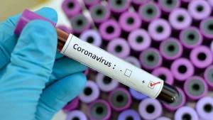One Hundred Thirty Four new cases for Coronavirus positives reported on July 19 in Udupi district